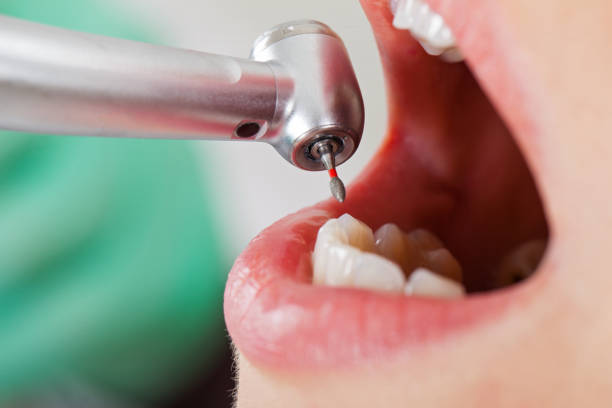 Best Cracked Tooth Emergency Dentist  in Highland, MD